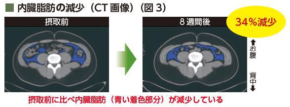 内臓脂肪の減少画像