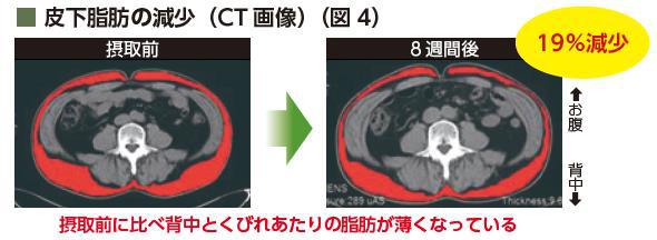 皮下脂肪の減少画像