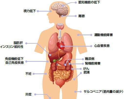 老化関連疾患