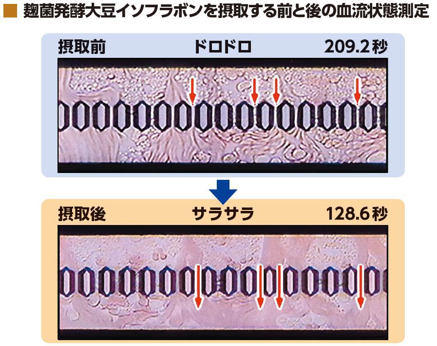 血流状態測定