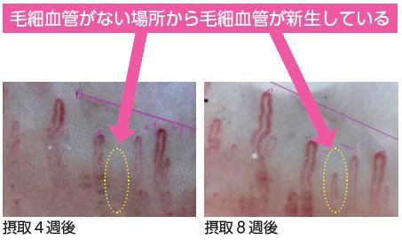 毛細血管が新生