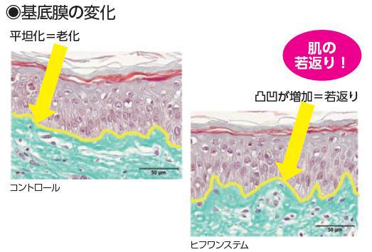 基底膜の変化