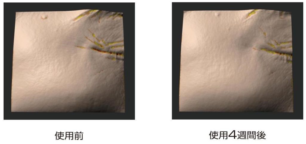 シワの変化