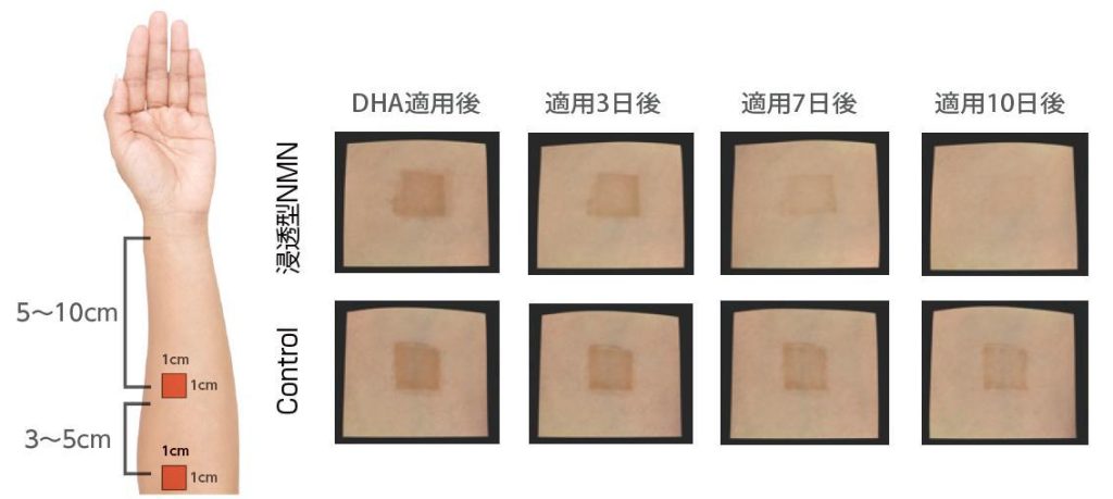 皮膚の変化