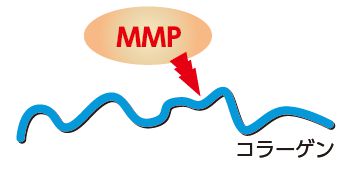 コラーゲンとMMP