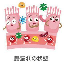 腸漏れの状態
