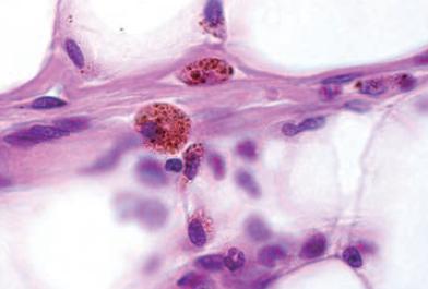 マクロファージイメージ