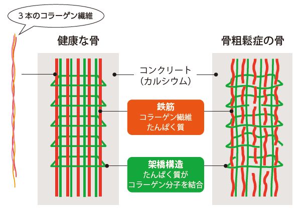 骨の構造と糖化による影響